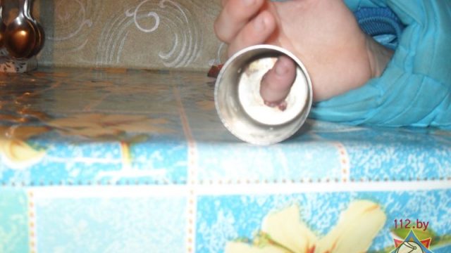 В Гомельской области 11-летняя девочка не могла достать палец из металлического подсвечника